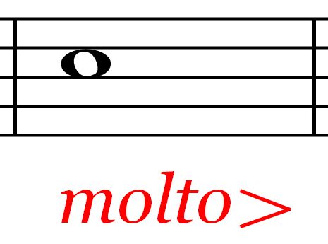 Molto Music Definition: Diverse Perspectives on the Essence of Music